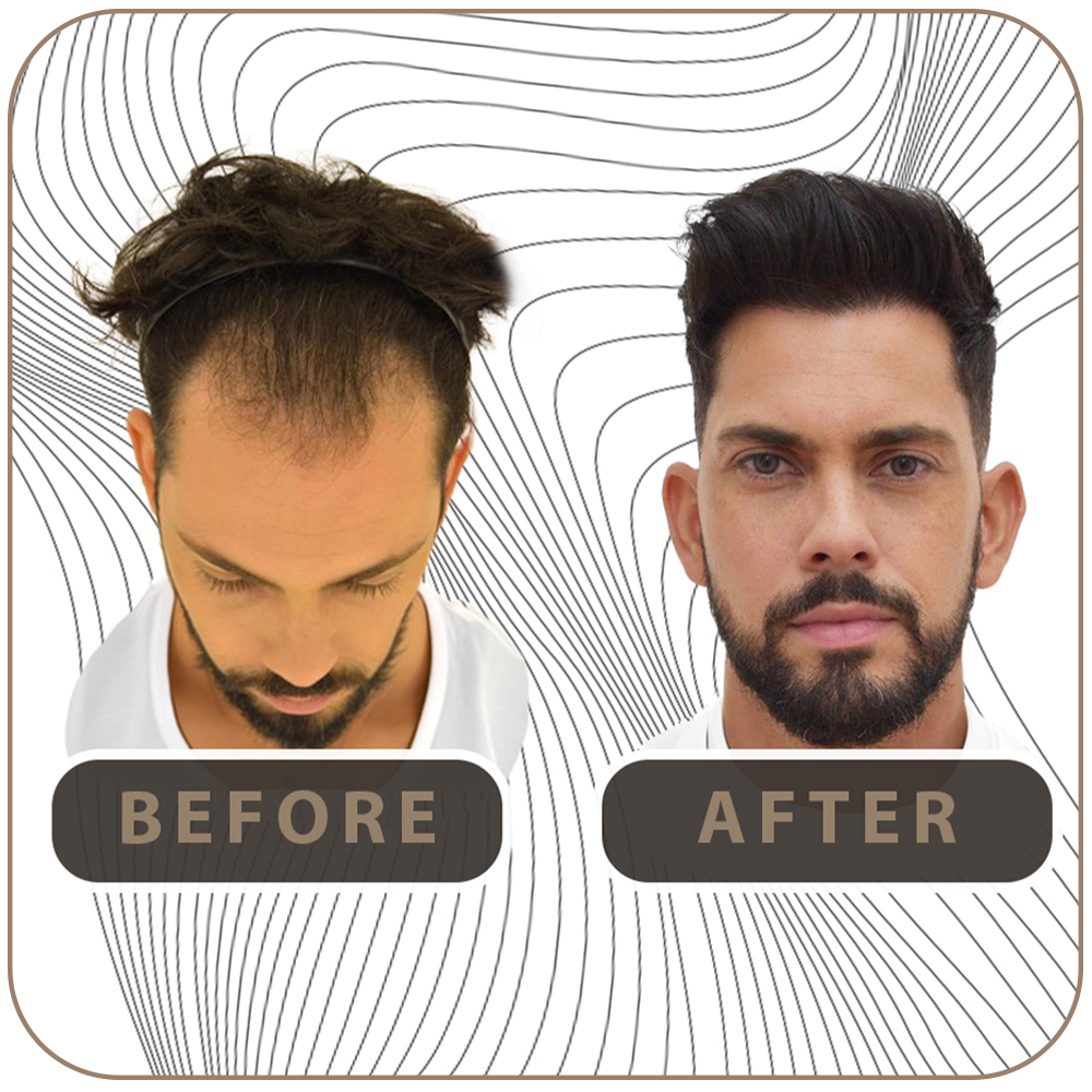 before-after-5