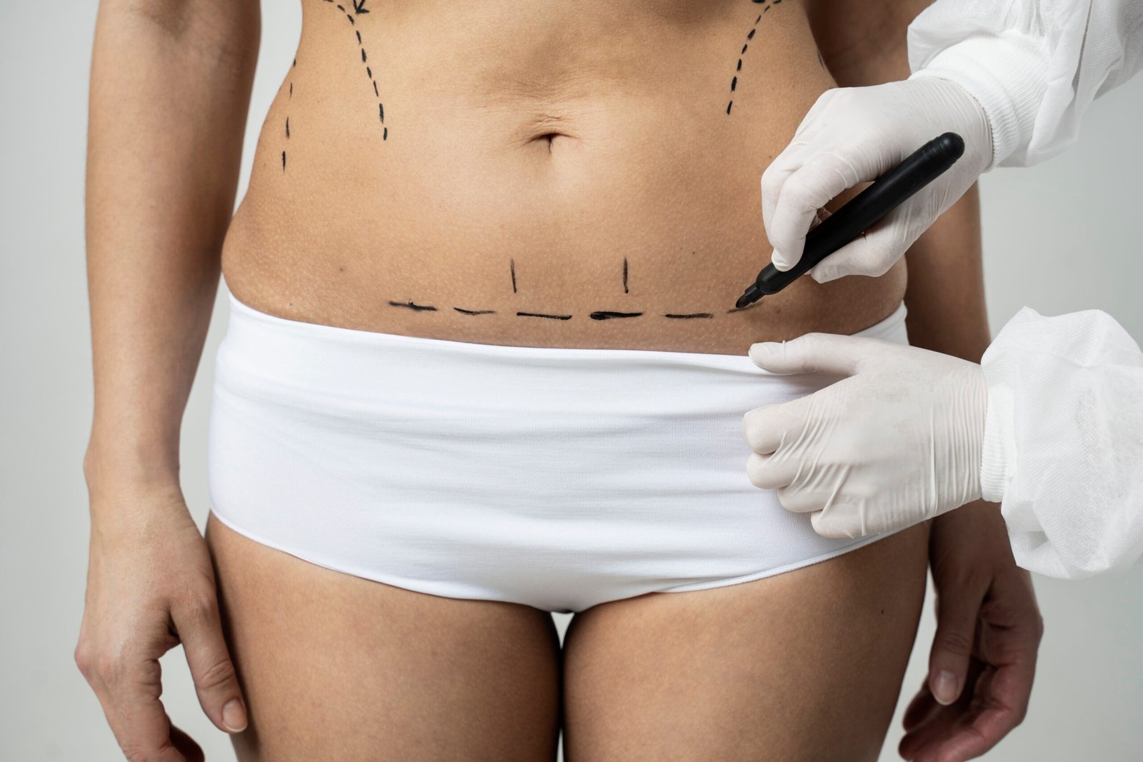 Tummy tuck surgery cost
